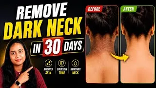 Thumbnail: How To Remove Neck Darkness? *Darkness Around Neck In Telugu* ⁨@bestbeautystelugu⁩