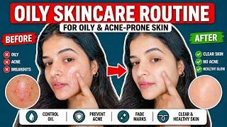 Thumbnail: The Ultimate 5-Step Skincare Routine for Oily & Acne-Prone Skin 2026 | Beauty Tips Buzz
