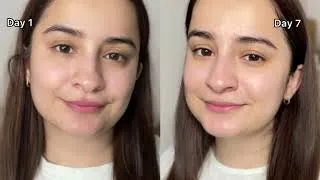 Thumbnail: I took 7 day micellar water cleansing challenge 😱🤓