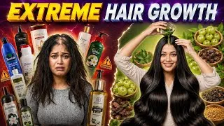 Thumbnail: 🤦‍♀️ Why Your Hair Is Not Growing (And How to Fix It)| The Ultimate Hair Care Guide