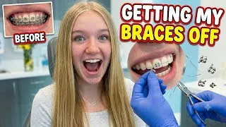 Thumbnail: Trinity Gets Her Braces Off!!