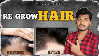 Thumbnail: Natural Ways To *RE-GROW* your Lost Hair🦱 #hair #mensfashion #ayejude #thefashionverge