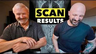 Thumbnail: MY DAD & I REACT TO MY NEW CT SCAN... After 6 Months of Chemo | Cancer Update