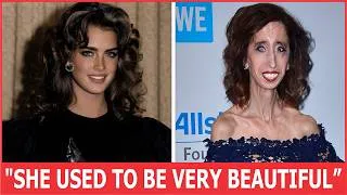 Thumbnail: 20 Celebrities Who Have Aged Horribly That Unrecognizable