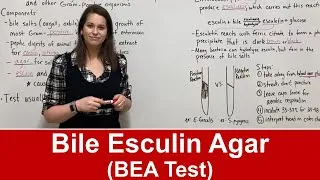 Thumbnail: Bile Esculin Agar (BEA Test)