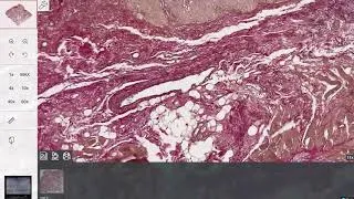 Thumbnail: The Histoscan portal for education in pathology