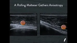 Thumbnail: Rolling Stones