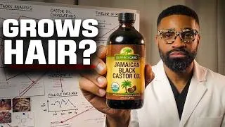 Thumbnail: Jamaican black castor oil for FAST hair growth. Does it work?