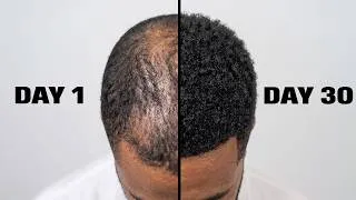 Thumbnail: if I had 30 days to regrow my hair, I’d do this