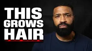 Thumbnail: I helped 500 men stop hair loss. (This is what works)