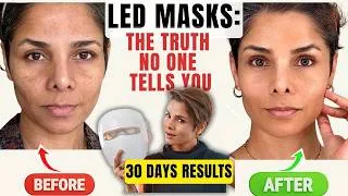 Thumbnail: No One Tells You This About LED Masks (Ulike ReGlow 1 Month Before & After)