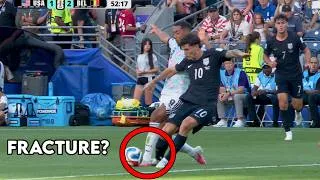 Thumbnail: Christian Pulisic Broke His Leg vs Belgium (Kind of) - Doctor Explains