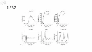 Thumbnail: Retina Chapter 3: Physiology