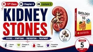 Thumbnail: Kidney Stones | Causes, Symptoms & Treatment | Class 10th Biology | Chapter 4