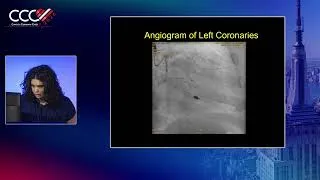 Thumbnail: Treating Cardiogenic Shock with Impella withEscalation to ECMO |    Angela Khidhir DO, MSc