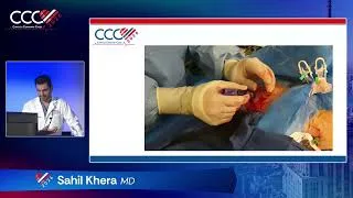 Thumbnail: Percutaneous Large Bore   Conventional and Alternative Access | Sahil Khera MD