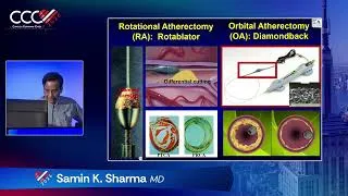 Thumbnail: Percutaneous Coronary Revascularization with Hemo Support | Samin K Sharma, MD
