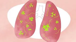 Thumbnail: Underestimated & Overlooked: The Silent Impact of Pesticides on Children (1 minute version)