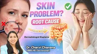 Thumbnail: Stop Using Expensive Creams I Stop Blaming Hormones! Skin Issues Start in Your Gut I Gut Health Tips
