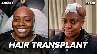 Thumbnail: So I got a hair transplant... IN TURKEY!