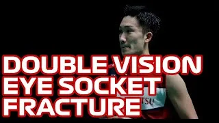 Thumbnail: How Kento Momota's Car Accident Affects His Career