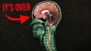 Thumbnail: A man hiked in the woods. Every brain cell got cooked.