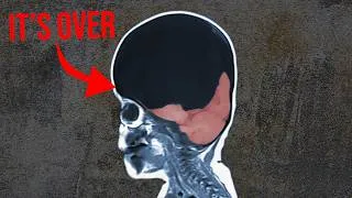 Thumbnail: Rabies Situation Is Insane
