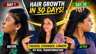 Thumbnail: Hair Growth in 30 Days😳🌱 | My Real Hair Transformation (Before & After) #haircare #hair #hairgrowth 