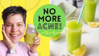 Thumbnail: Apple Ginger Lemon Juice (Clear Skin Recipe) 🍏🫚🍋🥒