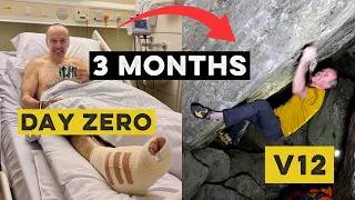 Thumbnail: Surgeon's table to V12 in three months: How 5 surgeries taught me to regain form fast