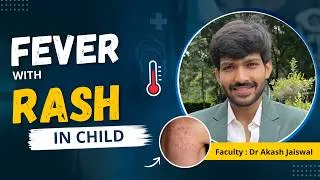 Thumbnail: Fever with Rash in Child