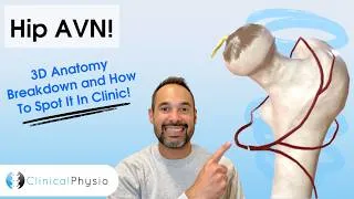 Thumbnail: Avascular Necrosis (AVN) of the Hip Explained | Blood Supply & Pathology