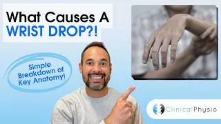 Thumbnail: Wrist Drop Explained | Common Causes & Anatomy for Physiotherapists