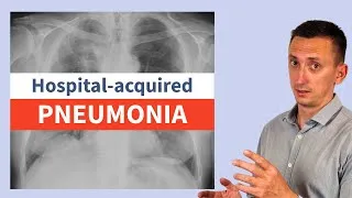 Thumbnail: Hospital-Acquired Pneumonia Explained: Diagnosis, Pitfalls, and Key Differences from CAP