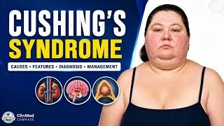 Thumbnail: Cushing’s Syndrome: A Clinical Review
