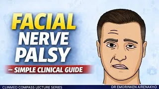 Thumbnail: Facial Nerve Palsy: A Simple Clinical Guide