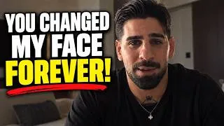 Thumbnail: “MY FACE IS RUINED!” Ilia Topuria Breaks Silence After Justin Fight