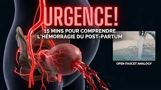 Thumbnail: 🔴15 mins pour COMPRENDRE l'hémorragie du post-partum