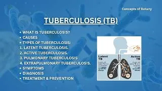 Thumbnail: Tuberculosis (TB) - Causes, Treatment, Prevention, Transmission.