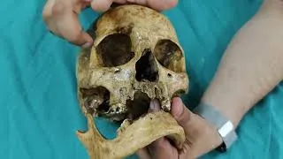Thumbnail: Osteology of Skull (norma frontalis)