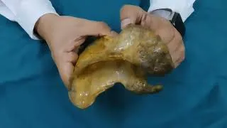 Thumbnail: Osteology of Scalpula 