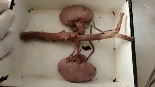 Thumbnail: Kidney (external features)