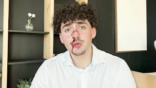 Thumbnail: Addressing The Allegations..