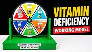 Thumbnail: vitamin deficiency diseases working model for science project exhibition - diet  craftpiller