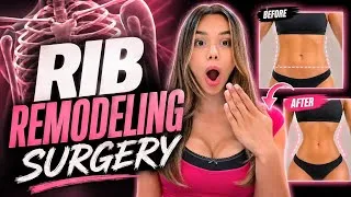 Thumbnail: I’M GETTING RIB REMODELING SURGERY!!?