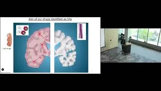 Thumbnail: MDF Pilot Grant Update Pt. 2 | 2025 Annual Huntington's Disease Education Day