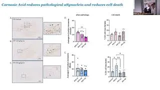 Thumbnail: Carnosic acid as a potential treatment for Parkinson’s – Dr Sinéad O’Sullivan