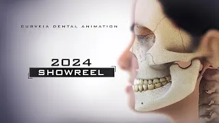 Thumbnail: Epic Animation Demo Reel | 2024 | Curveia Dental Animation