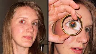 Thumbnail: What's Really Inside Your Eyes