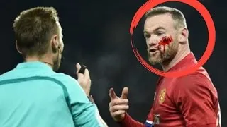 Thumbnail: Wayne Rooney blood face (injury)